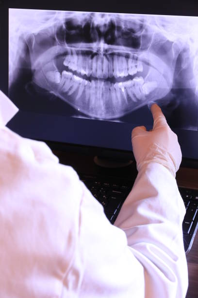 Best Knocked-Out Tooth (Avulsed Tooth) Treatment in Finneytown, OH