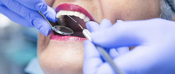 Best Emergency Denture Repair in Finneytown, OH